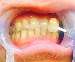 Natick Family Dental Natick Family Dental